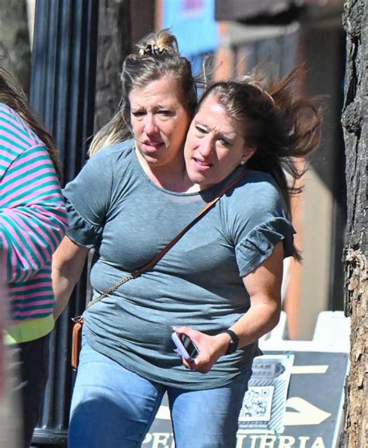 Abby and Brittany: The Journey of Conjoined Twins and Their Legacy