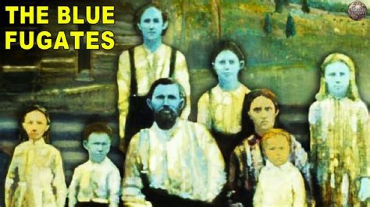 Unveiling the Mystery of the Blue People of West Virginia