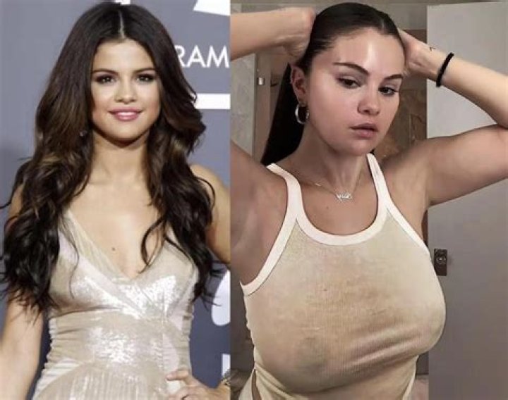 Did Selena Gomez Get Breast Implants? Unraveling the Truth Behind the Speculation