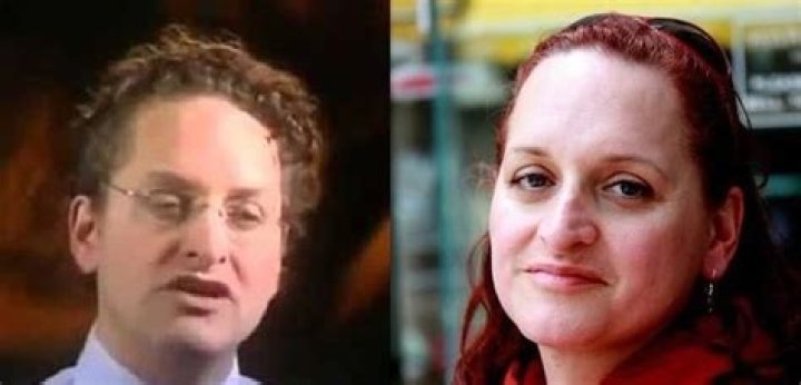 Revealing Dr. Lynette Nusbacher's Journey: Before the Life-Changing Surgery