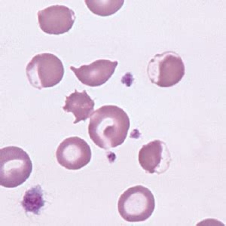 Essential Insight into Eccentrocytes: A Comprehensive Examination