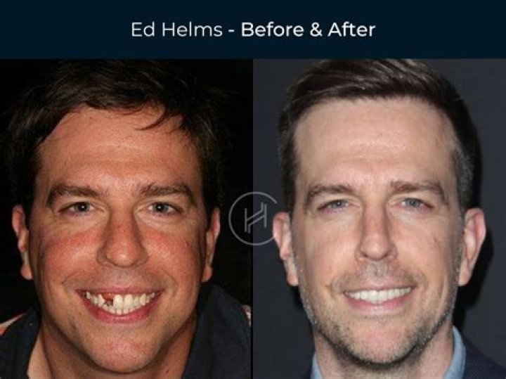 Exploring the Intricacies of Ed Helms' Relationship Journey