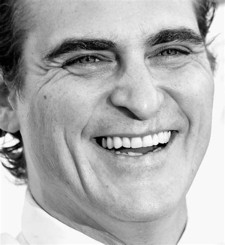 Exploring the Life and Career of Hair Lip Actor