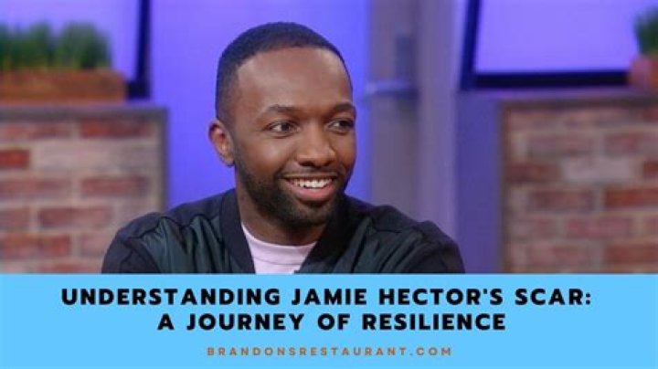 Jamie Hector's Defining Scar: A Symbol of Resilience and Authenticity