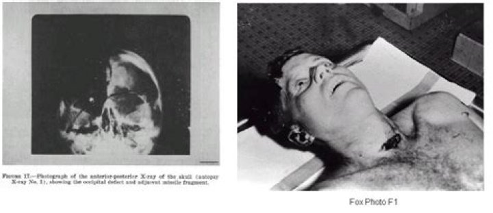John F. Kennedy Morgue Photos: A Deep Dive into a Historical Controversy