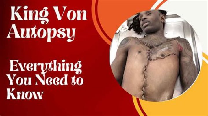 King Von Dead Autopsy: Unraveling the Truth Behind the Tragic Death