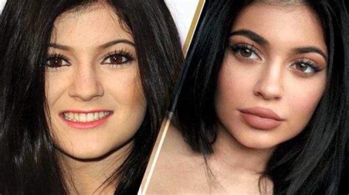 Kylie Jenner Before Pics: Unveiling Transformation and Evolution