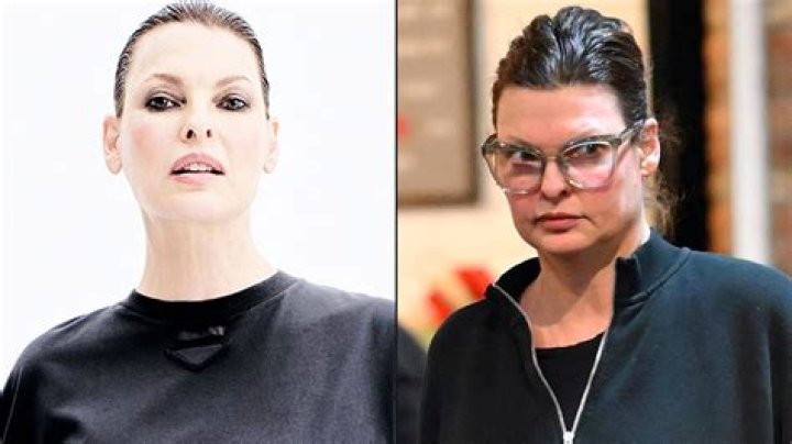 Linda Evangelista and CoolSculpting: A Comprehensive Guide