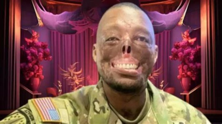 Randy Adams Face Accident: A Deep Dive into the Incident and Its Impact