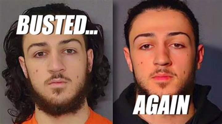 Squeeze Benz Face: Everything You Need to Know About This Popular Skincare Trend