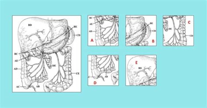 TSM Test: Comprehensive Guide and Insights