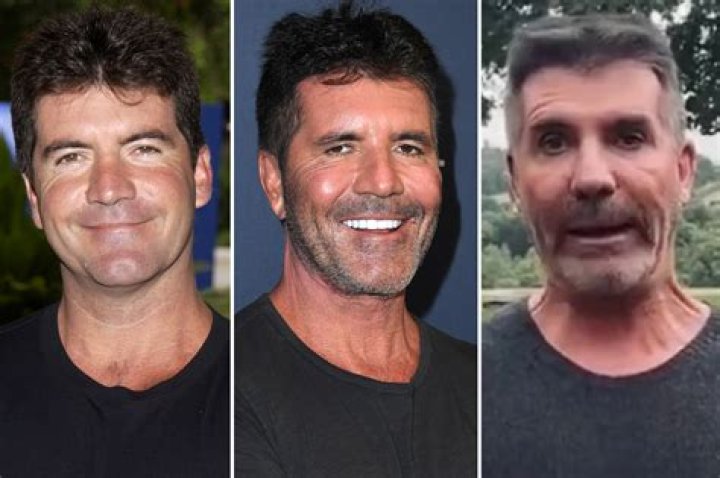 What Happened to Simon Cowell: A Comprehensive Overview
