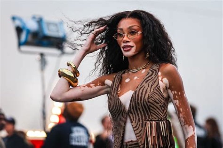 Winnie Harlow's Astounding Net Worth: A Journey of Resilience and Success